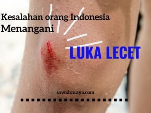 3 Kesalahan Orang Indonesia Dalam Merawat Luka Lecet