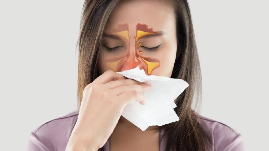 penyebab sinusitis, sinusitis, infeksi sinus, alergi, polip hidung, polusi udara, imun lemah, pencegahan sinusitis