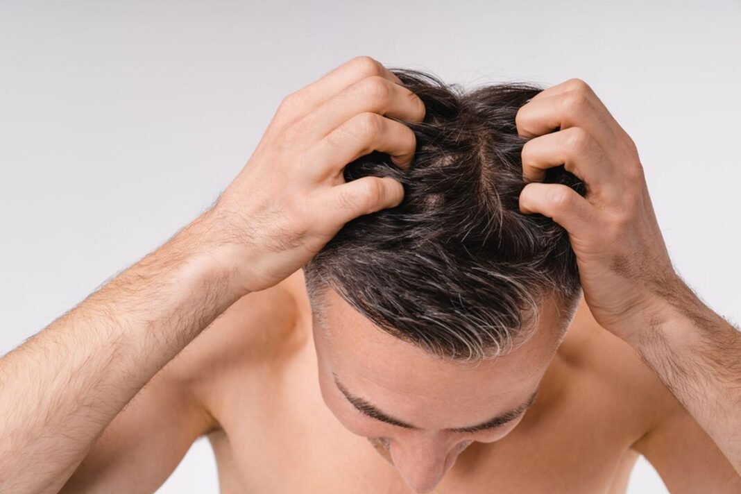 Alasan Mengapa Pemahaman Define Scalp Adalah Hal Penting
